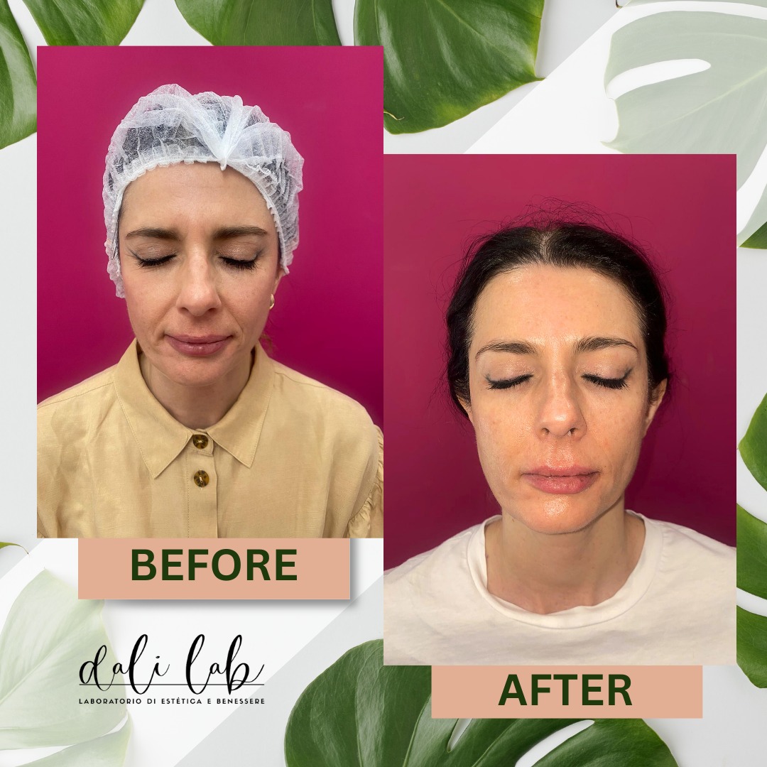 Trattamento viso — risultato prima e dopo